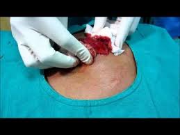 Pin On Bodily Secretions