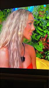 Brandi Glanville reveals she hasn't had sex in a year as she battles facial  disfigurement