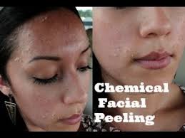 ( peelings mecanicos) y peeling quimico: Peeling Facial En Casa Dia 1 2 Y 3 Youtube