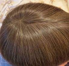 Thicken It Hair Powder 100 Scalp Coverage Hair Powder Hairstyles For Thin Hair Hair