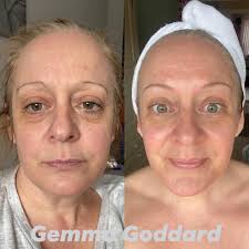 ✨✨✨The Results Speak Volumes! ✨✨✨ WOW!!! Sharing one of my favourite  results photos, shows how powerful the LumiSpa device really is 💥 This  beautiful lady is my business partners mum, who's been