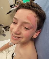 Partner's severe burns from petrol fire