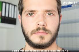 Minoxidil Bart Erfahrungsbericht über zwei Jahre mit Bildern