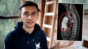 We did not find results for: Ich Beantworte Eure Fragen Zu Meinem Tumor Youtube