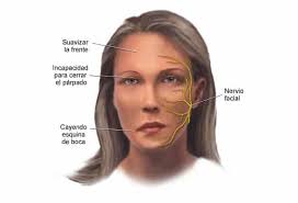 In strokes, blockages or issues with blood flow to the brain may cause permanent damage. Bell S Palsy Symptoms And Treatment You Should Know Nwz