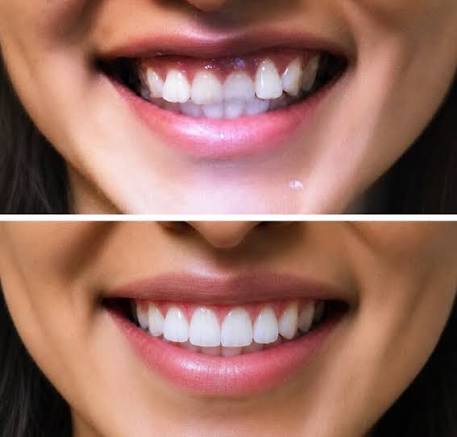 Face-First Orthodontics” Isn't Just a Catchphrase. It's How We Plan Every  Smile. Many orthodontists focus primarily on straightening teeth. At Pana  Orthodontics, we start with the face. What does that actually mean?