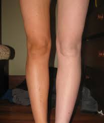 One Leg Using Tropic Spa S Home Mist Spray Tan Unit One Without Clearly Would Rather Rock The Tanned One This Summer Mobile Spray Tanning Spray Tanning Tan