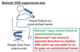 Image result for Visual Fixation