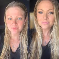 how to cover up Xanthelasma?