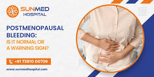 Image result for Postmenopausal Bleeding