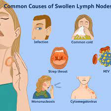 First of all, i had a sore throat (like the start of strep throat) for a couple of days. How To Tell A Lump From A Lymph Node