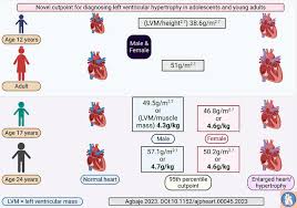 Image result for Left Ventricular Hypertrophy