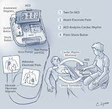 Online, article, story, explanation, suggestion, youtube. What Does A Defibrillator Look Like Aed Usa Knowledge