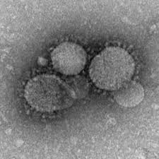 How do camels adapt to their environment? Study Documents Mers Spread From Camel To Person
