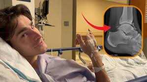 Getting my Broken Ankle Fixed