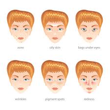 Maybe you would like to learn more about one of these? Dunkle Flecken Von Akne Im Gesicht Aufhellen