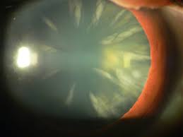 Image result for Isoglossa cataractarum