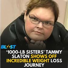 Post Caption⁠ #TammySlaton is receiving an outpouring of support from fans  as she continues her impressive #weightloss journey.⁠ ⁠ #TLC's "1000-Lb  Sisters" star recently debuted her slimmed-down figure in a swimsuit, posing