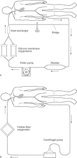 arterial cannula an overview sciencedirect topics