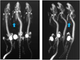 If you're a new client with st. Frontiers Low Dose Imaging In A New Preclinical Total Body Pet Ct Scanner Medicine