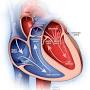 Cardiovascular disease from www.mayoclinic.org