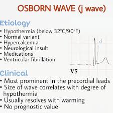 Image result for J Wave