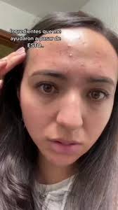 Erika Trejo Ruiz (eifel124)