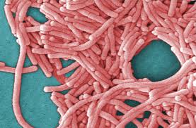 Upper East Side Legionnaires' cases now at 14, NYC health department says