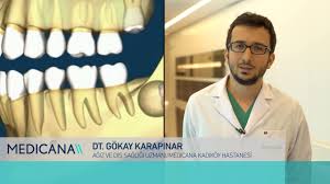 20 Yas Disleri Cene Kisti Olusmasina Sebep Olur Mu Youtube