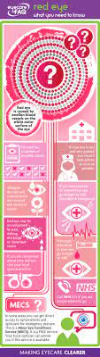 Pin On Eyecare Infographics