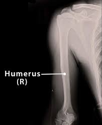 Image result for Humerus Bone