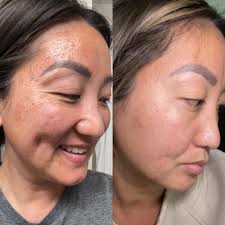 Why consider reordering herbal face food?