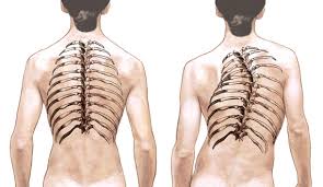 Maybe you would like to learn more about one of these? Why Does One Of My Ribs Stick Out More Www Themusclemaster Com