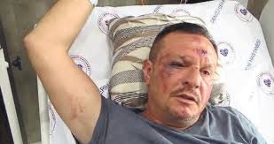 Eski başkana bıçak darbesi