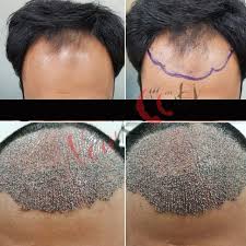 Dorset aesthetics ltd dermal fillers london, skin, Cosmetic Clinic Near Me