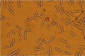 Image result for Cylindropsis