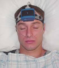 Prevalence of probable obstructive sleep apnea risk and severity in a  population of dental patients