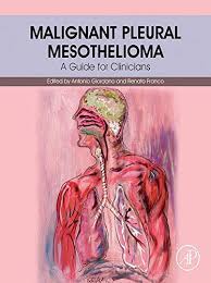 It occurs in the thin lining of tissues surrounding the internal organs of the body. Malignant Pleural Mesothelioma A Guide For Clinicians English Edition Ebook Giordano Antonio Franco Renato Amazon De Kindle Shop