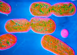 Image result for Shigella