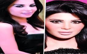 إيمان الحصري تستعد لعملية جراحية ثامنة حيث أثارت حالتها الصحية هلع الجمهور وقلقهم عليها بعد دخولها منذ حوالي 3 أشهر بأزمات صحية متتالية، فيما أعلن نجل الموسيقار السعودي طلال باغر عن التطورات في الحالة الصحية لوالده. Ø³Ø§Ø²Ø¯ÙŠÙ„ ÙˆÙŠÙƒÙŠØ¨ÙŠØ¯ÙŠØ§ ÙƒØ§ÙŠØ±Ùˆ ØªØ§ÙŠÙ…Ø²