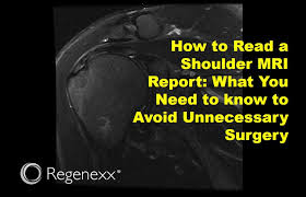 Image result for Shoulder MRI