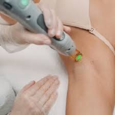 You can see how to get to laser partners on our website. Laser Hair Removal Tattoo Removal Laser Facial Laser Partners