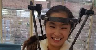 Scots figure skater bounces back from serious car crash and broken neck to  qualify for championships