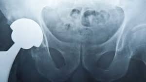Image result for https://www.neogenstemcell.com/