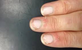 When you find yourself biting your nails. Here S Why You Should Stop Biting Off The Skin Around Your Fingernails This Is Alarming