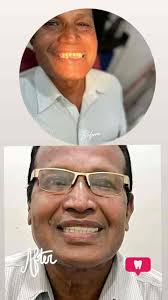 Dentists in Tankaria, Bharuch