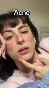 Avra Una Faccia Nuova