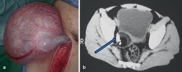 We did not find results for: Teratoma Springerlink