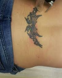 There is minimal discomfort during and after the procedure. Atlantic Laser Tattoo Removal Home Facebook