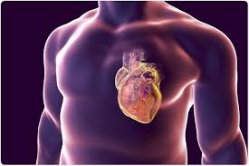 Image result for Myocarditis